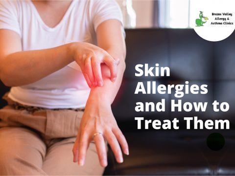 Skin Allergy