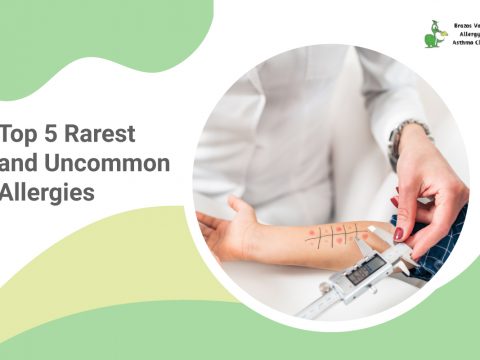 uncommon allergies