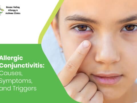 allergic conjunctivitis