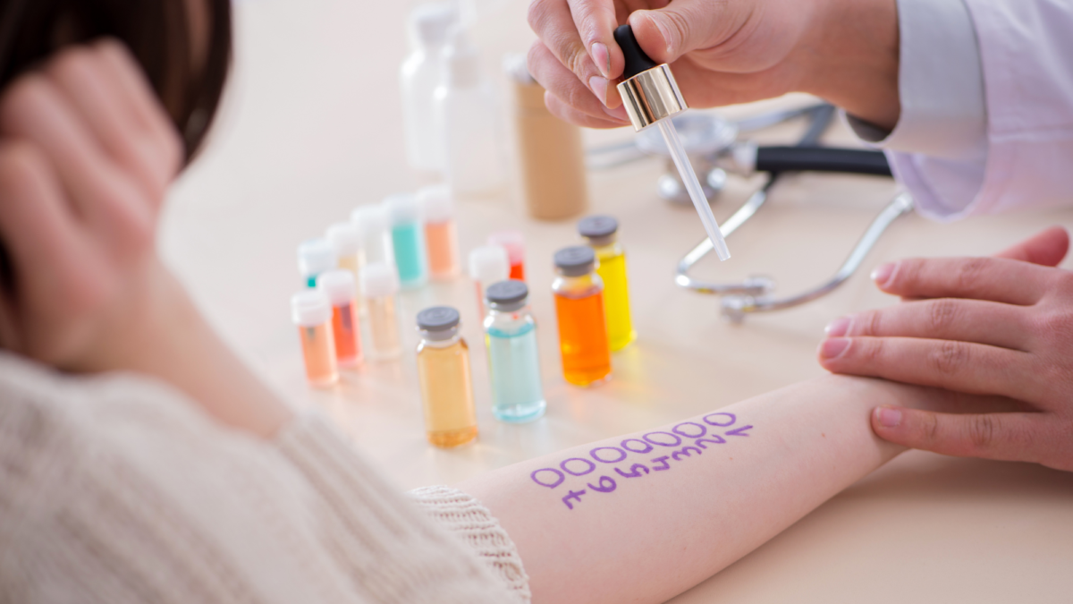 An allergist performs a pre-holiday allergy test on a patient’s arm using dropper samples to identify allergic triggers.