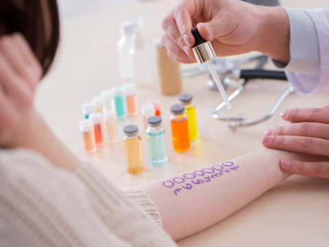 An allergist performs a pre-holiday allergy test on a patient’s arm using dropper samples to identify allergic triggers.